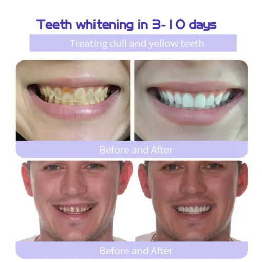 Cvreoz® Teeth Restoration Mineral Powder - Image 11