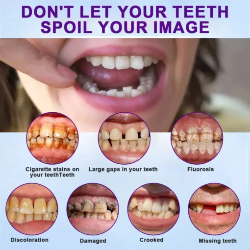 LOVILDS™ Silicone Lined Denture Set