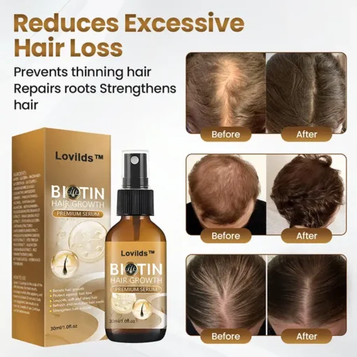 Lovilds™ Biotin HairRevive Growth Premium Serum