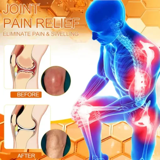 ✅Official Store: GJYYDX™ Bee-Venom Pain-Relief Bone Healing Cream👨‍⚕️Orthopaedic Association(AAOS) Approved (Reducing joint swelling, pain, stiffness, redness, warmth, soreness, and joint fatigue)