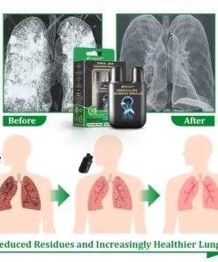 Ourlyard™ Herbal Lung Cleansing Inhaler