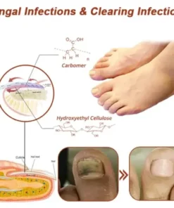 QIAWI™ Revolutionary High-Efficiency Light Therapy Device For Toenail Diseases