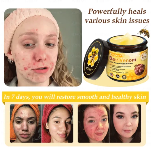 VLSVLS™ Bee Venom Skin Restoration Cream