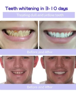 AEXZR™ Teeth Restoration Mineral Powder - UP TO 50% OFF