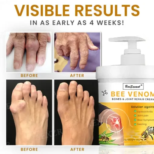 BeeSavant™ Bee Venom Bones & Joint Repair Cream