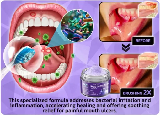 ✅Official Store | BBOJI™ Tooth Health Mineral Powder👄MHRA-Certified (for the treatment of periodontitis and oral ulcers, prevention of tooth loss, and repair of gum recession)