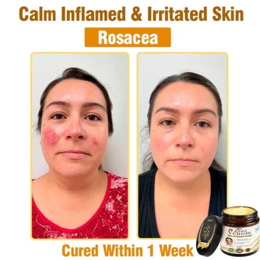 Raindew® Full-Body Repair Cream: Anti-Aging, Hydration, Skin Repair, Even Tone, Acne & Dark Spot Treatment, Wart & Mole Removal, Psoriasis Relief