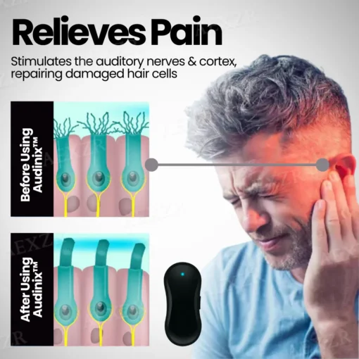 Audinix™ Tinnitus Relieving Device