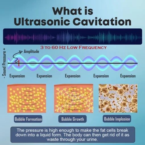 Histone™ Ultrasonic Fat Blasting & Far Infrared Blood Sugar Balancing Detox Wristband