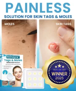 Skinayre™ Tags & Moles Remover Patch